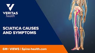 Sciatica Causes and Symptoms [upl. by Kalfas91]