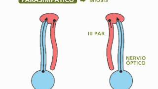 Reflejos pupilares  Oftalmología [upl. by Stultz]