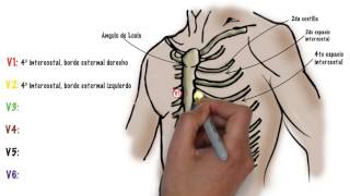 Como hacer un ECG electrocardiograma [upl. by Aisyram]