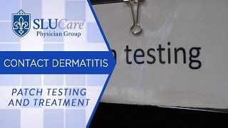 Patch Testing and Treatment for Contact Dermatitis  SLUCare Dermatology [upl. by Sirrom]