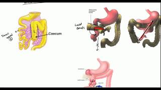 How do you fix a dropped uterus  Dr Sahana K P [upl. by Adnaw]