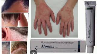 Montaz Cream Mometasone Furoate Cream USP [upl. by Nywg]