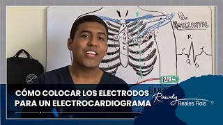 CÓMO COLOCAR LOS ELECTRODOS PARA UN ELECTROCARDIOGRAMA ECG  DR RAWDY [upl. by Plante]