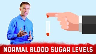 What is Normal Fasting Blood Sugar Levels on Intermittent Fasting – DrBerg [upl. by Nagem]