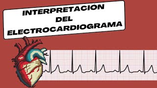 Interpretación del Electrocardiograma [upl. by Wendin]