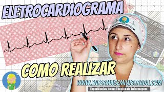 ELETROCARDIOGRAMA Como é Realizado [upl. by Idas]