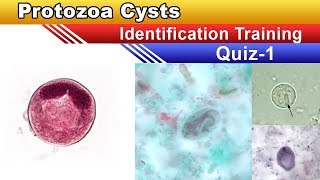 Protozoa Cysts Identification Training Quiz  Part 1 [upl. by Bruner]