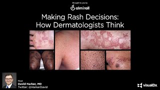 Making Rash Decisions How Dermatologists Think  Dr David Harker [upl. by Ytisahcal]