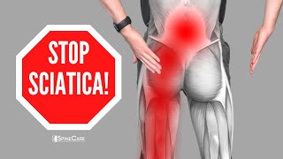 How to Relieve Sciatica Pain in SECONDS [upl. by Origra]