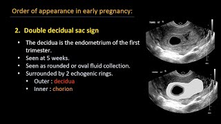 Ultrasound of normal early pregnancy [upl. by Laughton320]